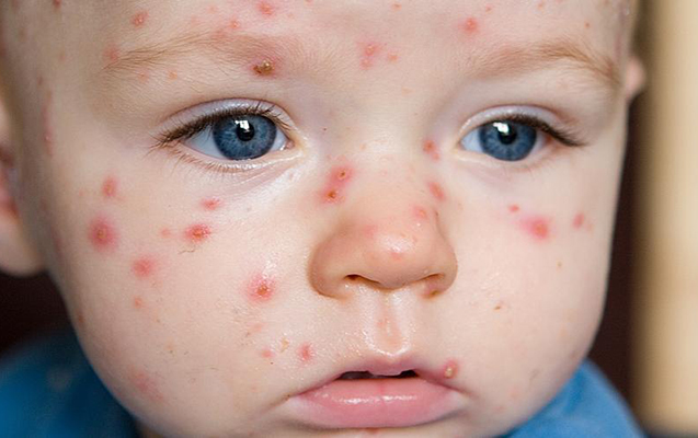 suciceyi-ile-bagli-olum-hali-olmayib